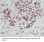 Transcription Factor SOX-2 (SOX2) Antibody