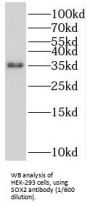 Transcription Factor SOX-2 (SOX2) Antibody