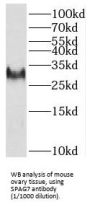 Sperm-Associated Antigen 7 (SPAG7) Antibody