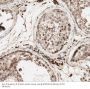 Spermatogenesis Associated 6 (SPATA6) Antibody