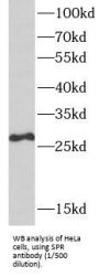 Sepiapterin Reductase (7,8-Dihydrobiopterin:NADP+ Oxidoreductase) (SPR) Antibody