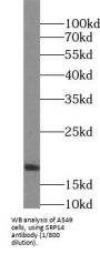 Signal Recognition Particle 14 (SRP14) Antibody