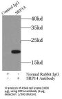 Signal Recognition Particle 14 (SRP14) Antibody