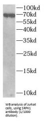 SRSF Protein Kinase 1 (SRPK1) Antibody