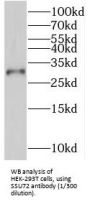 RNA Polymerase II CTD Phosphatase Homolog (SSU72) Antibody
