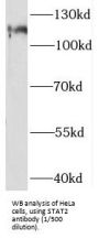 Signal Transducer And Activator of Transcription 2 (STAT2) Antibody