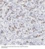 Signal Transducer And Activator of Transcription 2 (STAT2) Antibody