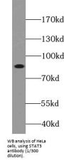Signal Transducer And Activator of Transcription 3 (STAT3) Antibody