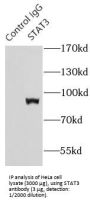 Signal Transducer And Activator of Transcription 3 (STAT3) Antibody