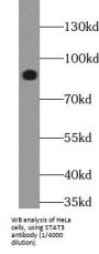 Signal Transducer And Activator of Transcription 3 (STAT3) Antibody