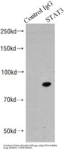 Signal Transducer And Activator of Transcription 3 (STAT3) Antibody
