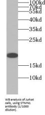 Stathmin 1 (STMN1) Antibody