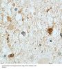 Stathmin 1 (STMN1) Antibody
