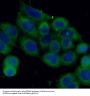 Stathmin 1 (STMN1) Antibody