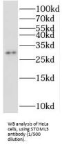 Stomatin-Like Protein 3 (STOML3) Antibody