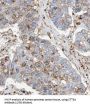 STT3A, Catalytic Subunit of The Oligosaccharyltransferase Complex (STT3A) Antibody