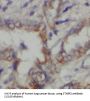 Syntaxin Binding Protein 2 (STXBP2) Antibody