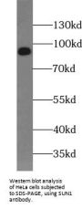 Sad1 And UNC84 Domain Containing 1 (SUN1) Antibody
