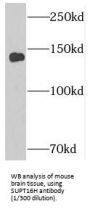 SPT16 Homolog, Facilitates Chromatin Remodeling Subunit (SUPT16H) Antibody