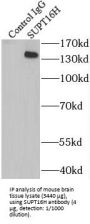 SPT16 Homolog, Facilitates Chromatin Remodeling Subunit (SUPT16H) Antibody