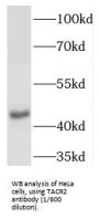 Tachykinin Receptor 2 (TACR2) Antibody