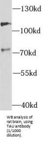 Microtubule-Associated Protein Tau (MAPT) Antibody