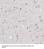 Transcription Elongation Regulator 1 (TCERG1) Antibody