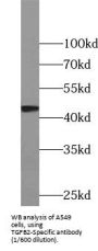 TGF-beta 2-Specific Antibody