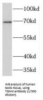 Transglutaminase 4, Prostate (TGM4) Antibody