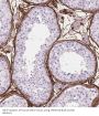 Transglutaminase 4, Prostate (TGM4) Antibody