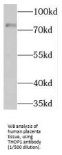 Thimet Oligopeptidase (THOP1) Antibody