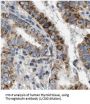 Thyroglobulin (TG) Antibody