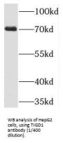 Tigger Transposable Element-Derived Protein 1 (TIGD1) Antibody