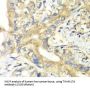 Mitochondrial Import Inner Membrane Translocase Subunit Tim17-A (TIMM17A) Antibody