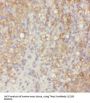 Metalloproteinase Inhibitor 3 (TIMP3) Antibody