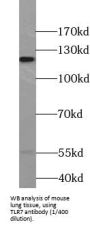 Toll-Like Receptor 7 (TLR7) Antibody