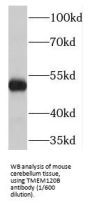 Transmembrane Protein 120B (TMEM120B) Antibody