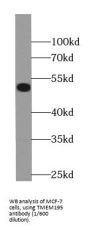 Transmembrane Protein 195 (TMEM195) Antibody