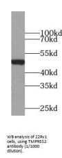 Transmembrane Protease, Serine 2 (TMPRSS2) Antibody