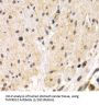 Transmembrane Protease, Serine 2 (TMPRSS2) Antibody