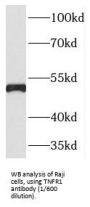 Tumor Necrosis Factor Receptor 1 (TNFR1) Antibody