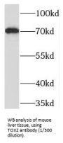 TOX High Mobility Group Box Family Member 2 (TOX2) Antibody