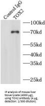TOX High Mobility Group Box Family Member 2 (TOX2) Antibody