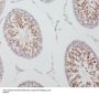 Putative Tyrosine-Protein Phosphatase TPTE (TPTE) Antibody