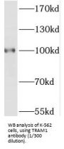 Translocating Chain-Associated Membrane Protein 1 (TRAM1) Antibody