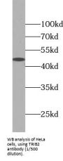 Tribbles Homolog 2 (TRIB2) Antibody