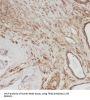 Tribbles Homolog 2 (TRIB2) Antibody