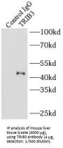 Tribbles Homolog 3 (TRIB3) Antibody