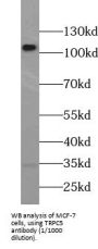 Transient Receptor Potential Cation Channel Subfamily C Member 5 (TRPC5) Antibody