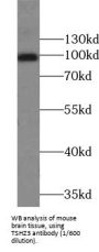 Teashirt Zinc Finger Homeobox 3 (TSHZ3) Antibody